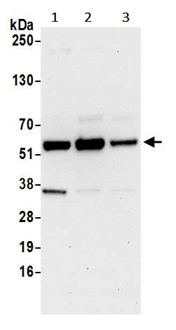 Western blot - Anti-WTAP antibody (AB245628), expandable thumbnail