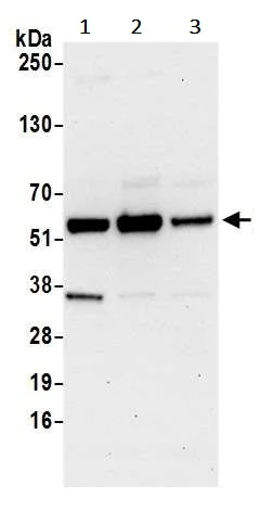 Western blot - Anti-WTAP antibody (AB245628)