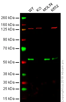 Western blot - Anti-WTAP antibody [EPR18744] (AB195380)