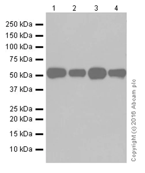 Western blot - Anti-WTAP antibody [EPR18744] (AB195380)