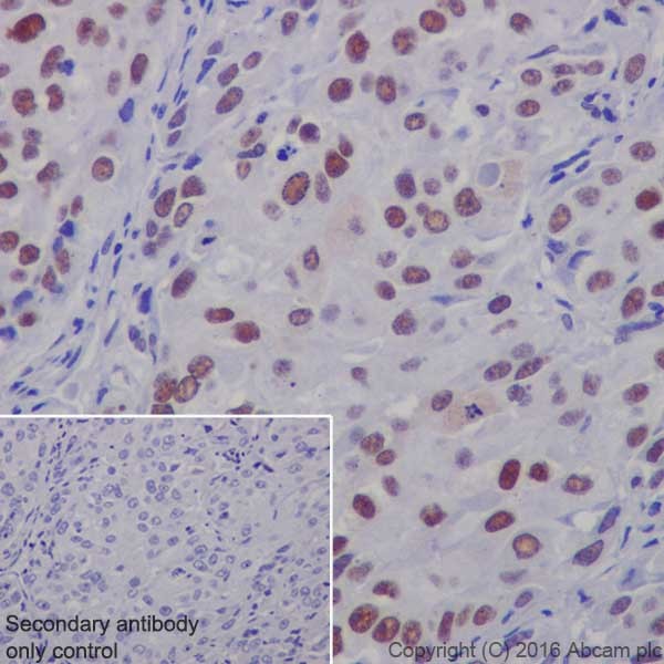Immunohistochemistry (Formalin/PFA-fixed paraffin-embedded sections) - Anti-WTAP antibody [EPR18744] - BSA and Azide free (ab232392), expandable thumbnail