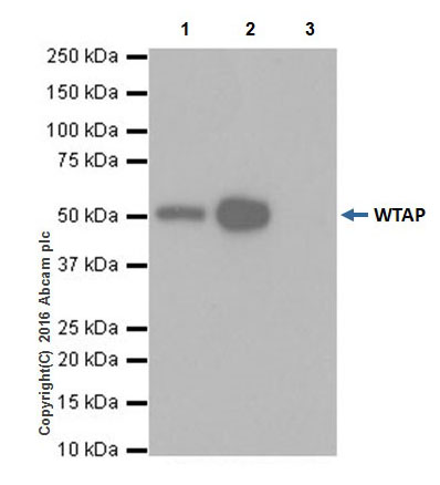 Immunoprecipitation - Anti-WTAP antibody [EPR18744] - BSA and Azide free (AB232392), expandable thumbnail