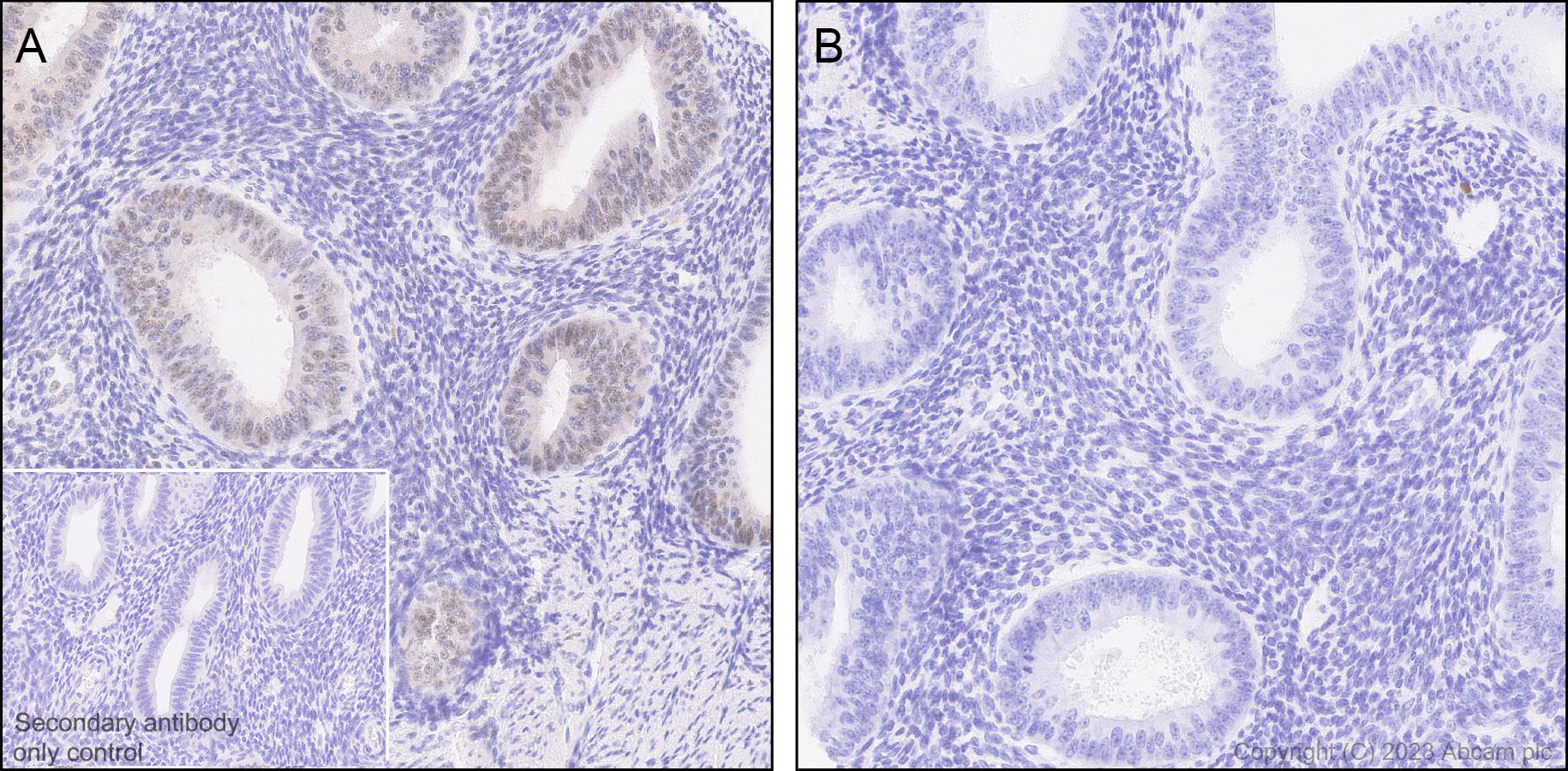 Immunohistochemistry (Formalin/PFA-fixed paraffin-embedded sections) - Anti-WTAP (phospho S341) antibody [EPR27039-57] (AB309350), expandable thumbnail
