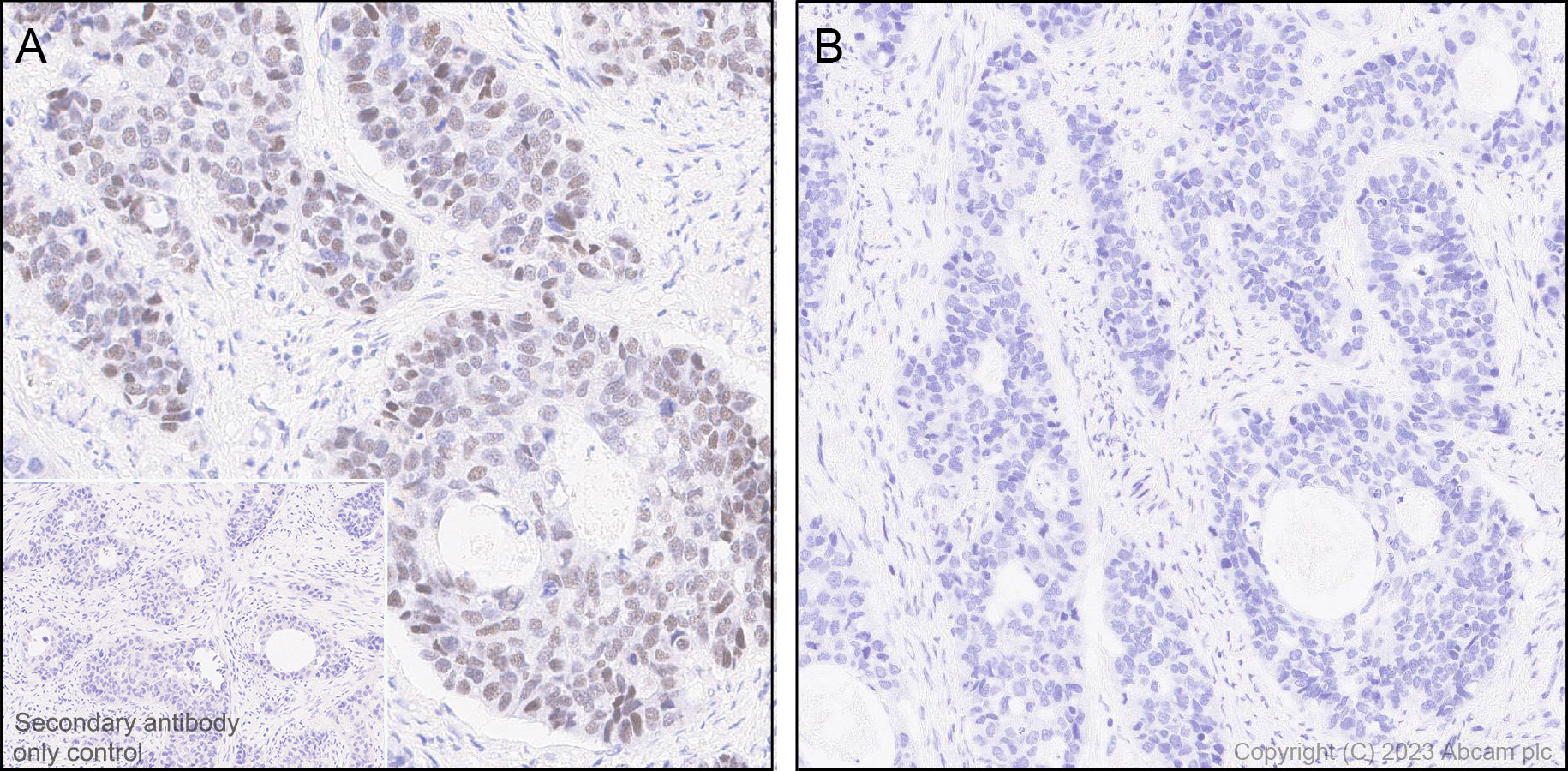 Immunohistochemistry (Formalin/PFA-fixed paraffin-embedded sections) - Anti-WTAP (phospho S341) antibody [EPR27039-57] (AB309350), expandable thumbnail