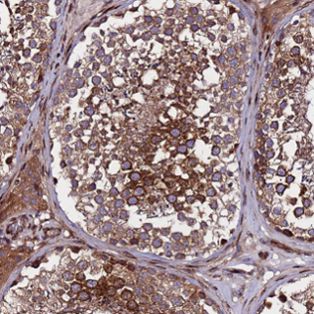 Immunohistochemistry (Formalin/PFA-fixed paraffin-embedded sections) - Anti-WWC2 antibody (AB126356)