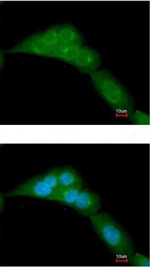 Immunocytochemistry/ Immunofluorescence - Anti-WWOX antibody (AB137726)