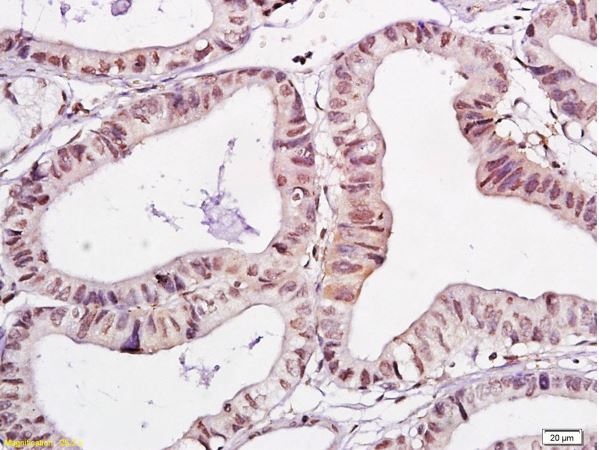Immunohistochemistry (Formalin/PFA-fixed paraffin-embedded sections) - Anti-WWOX antibody (AB216660)