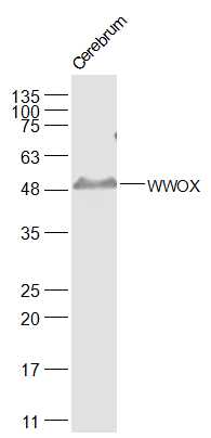 Western blot - Anti-WWOX antibody (AB216660)