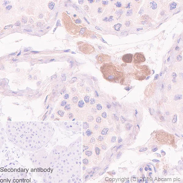 Immunohistochemistry (Formalin/PFA-fixed paraffin-embedded sections) - Anti-WWOX antibody [EPR23109-138] - BSA and Azide free (AB267348)