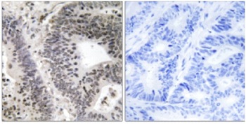 Immunohistochemistry (Formalin/PFA-fixed paraffin-embedded sections) - Anti-WWOX (phospho Y33) antibody (AB129881), expandable thumbnail