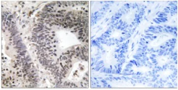 Immunohistochemistry (Formalin/PFA-fixed paraffin-embedded sections) - Anti-WWOX (phospho Y33) antibody (AB129881)