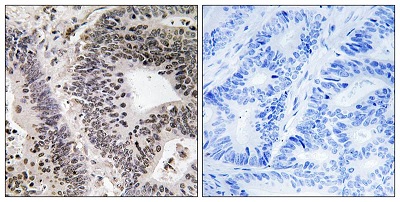 Immunohistochemistry (Formalin/PFA-fixed paraffin-embedded sections) - Anti-WWOX (phospho Y33) antibody (AB193624)