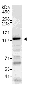 Immunoprecipitation - Anti-WWP1 antibody (AB104440)