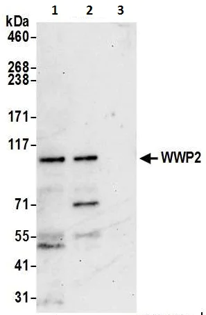 Immunoprecipitation - Anti-Wwp2 antibody (AB103527)