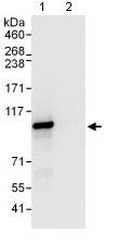 Immunoprecipitation - Anti-XAB2 antibody (AB129487), expandable thumbnail