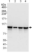 Western blot - Anti-XAB2 antibody (AB129487), expandable thumbnail