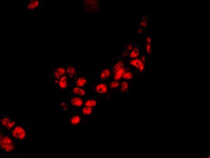 Immunocytochemistry/ Immunofluorescence - Anti-XAB2 antibody [EPR8971] (AB180181)