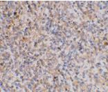 Immunohistochemistry (Formalin/PFA-fixed paraffin-embedded sections) - Anti-XAF1 antibody (AB17204)