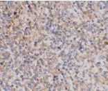 Immunohistochemistry (Formalin/PFA-fixed paraffin-embedded sections) - Anti-XAF1 antibody (AB17204)