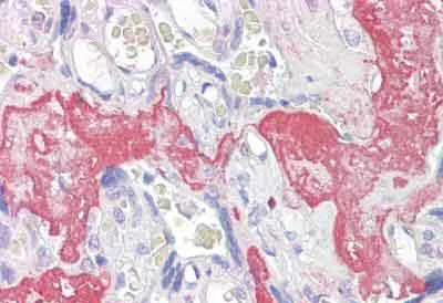 Immunohistochemistry (Formalin/PFA-fixed paraffin-embedded sections) - Anti-XAGE1 antibody (AB134805)