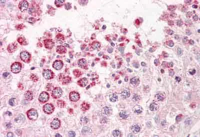 Immunohistochemistry (Formalin/PFA-fixed paraffin-embedded sections) - Anti-XAGE1 antibody (AB134805)