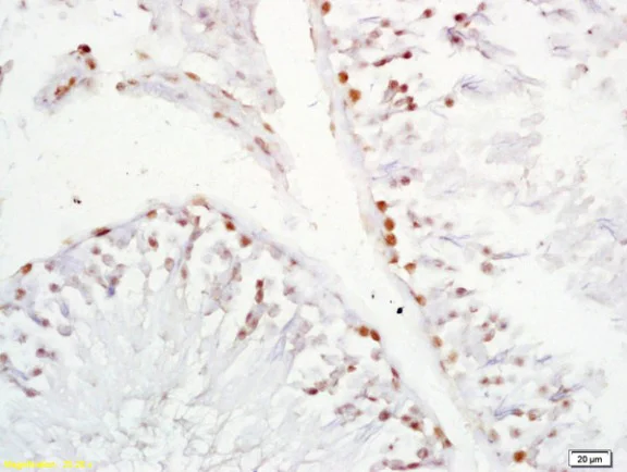 Immunohistochemistry (Formalin/PFA-fixed paraffin-embedded sections) - Anti-XAGE2 antibody (AB213157)