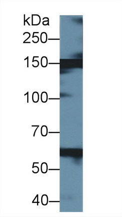 Western blot - Anti-Xanthine Oxidase antibody (AB231316), expandable thumbnail