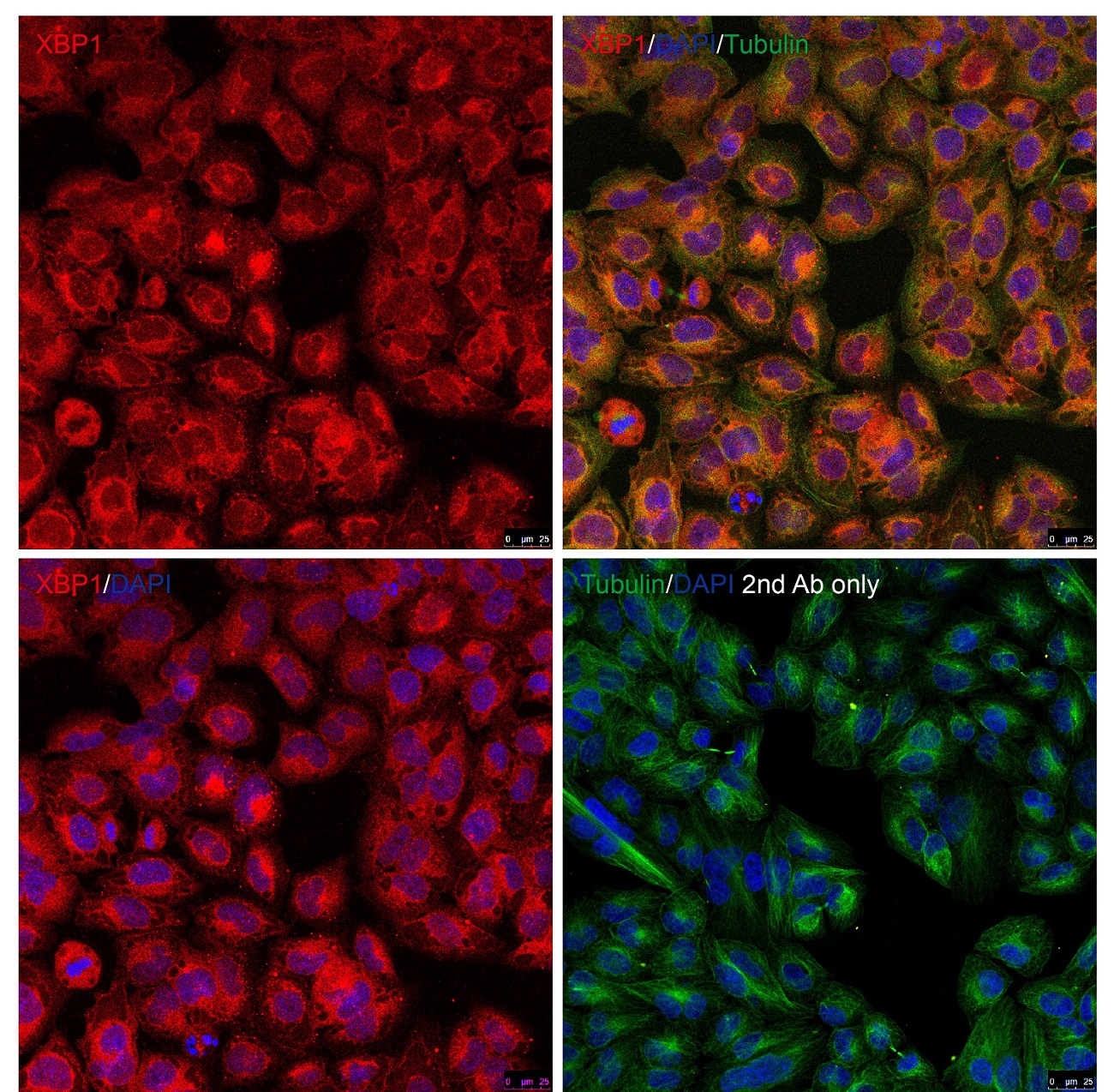 Immunocytochemistry/ Immunofluorescence - Anti-XBP1 antibody (ab37152), expandable thumbnail
