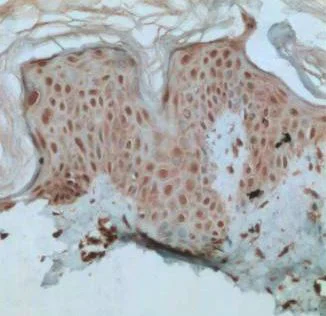 Immunohistochemistry (Formalin/PFA-fixed paraffin-embedded sections) - Anti-XBP1 antibody (AB37152)