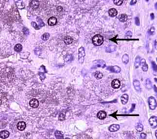 Immunohistochemistry (Formalin/PFA-fixed paraffin-embedded sections) - Anti-XBP1 antibody (AB37152), expandable thumbnail