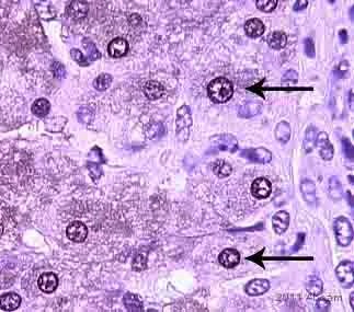 Immunohistochemistry (Formalin/PFA-fixed paraffin-embedded sections) - Anti-XBP1 antibody (AB37152)