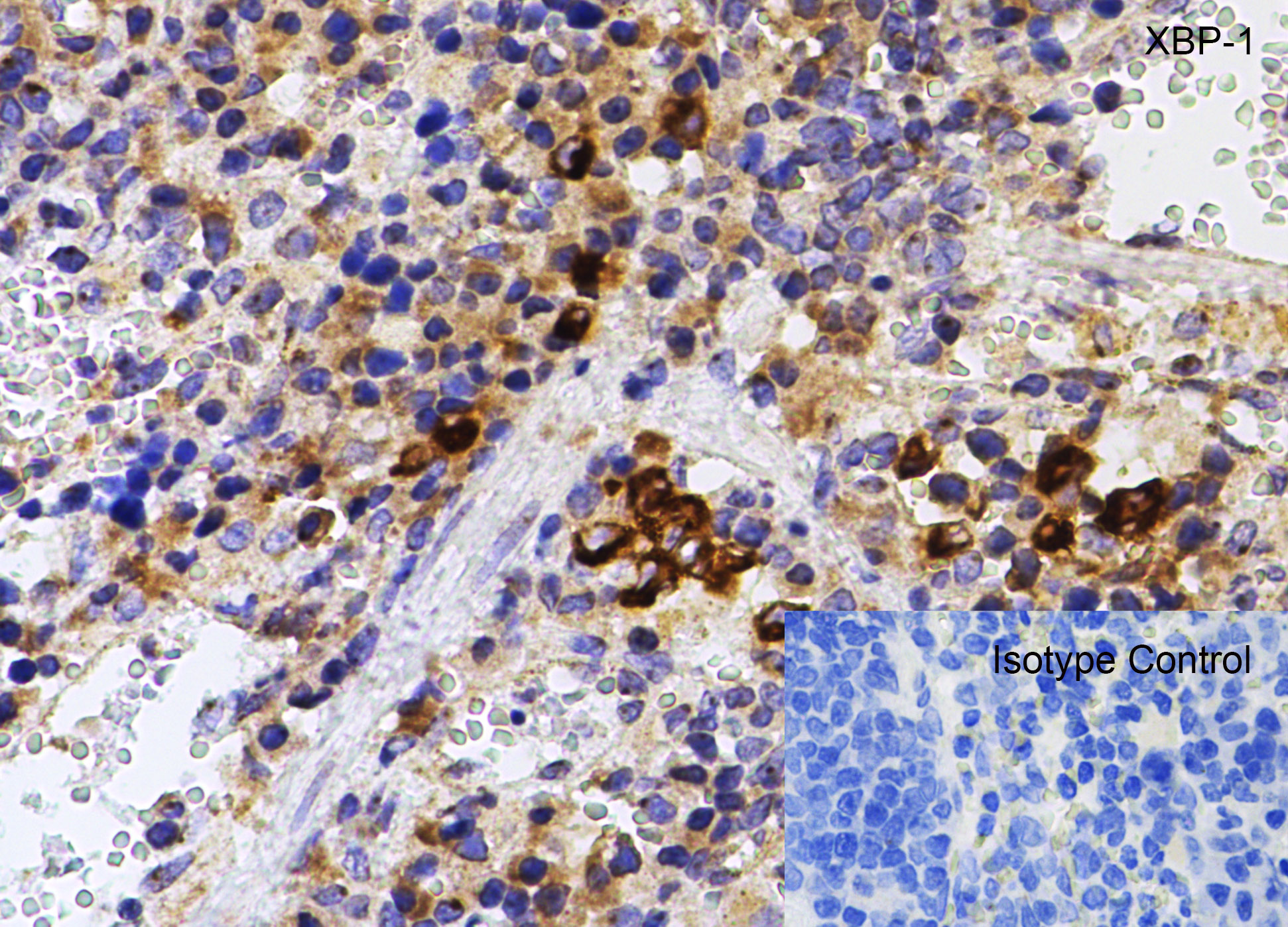 Immunohistochemistry (Formalin/PFA-fixed paraffin-embedded sections) - Anti-XBP1 antibody (ab37152), expandable thumbnail