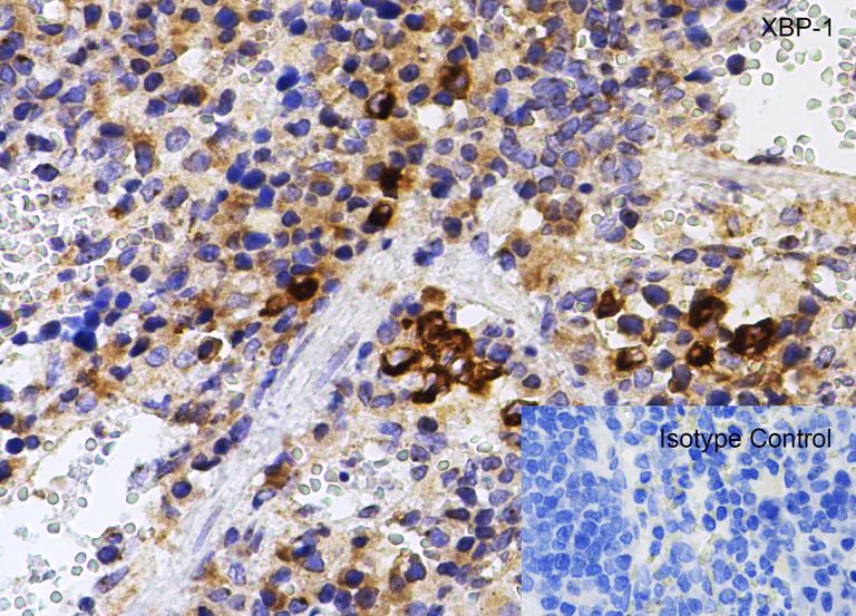 Immunohistochemistry (Formalin/PFA-fixed paraffin-embedded sections) - Anti-XBP1 antibody (AB37152)
