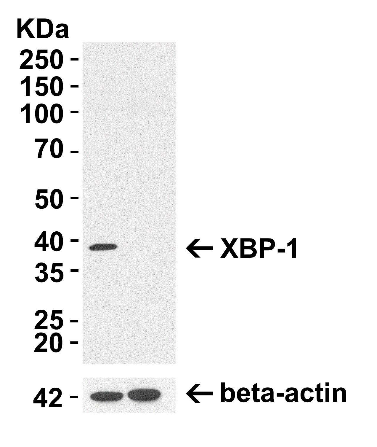 Western blot - Anti-XBP1 antibody (ab37152), expandable thumbnail