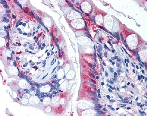 Immunohistochemistry (Formalin/PFA-fixed paraffin-embedded sections) - Anti-xCT antibody (AB37185)