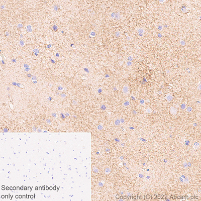 Immunohistochemistry (Formalin/PFA-fixed paraffin-embedded sections) - Anti-xCT antibody [EPR27115-64] (ab307601), expandable thumbnail