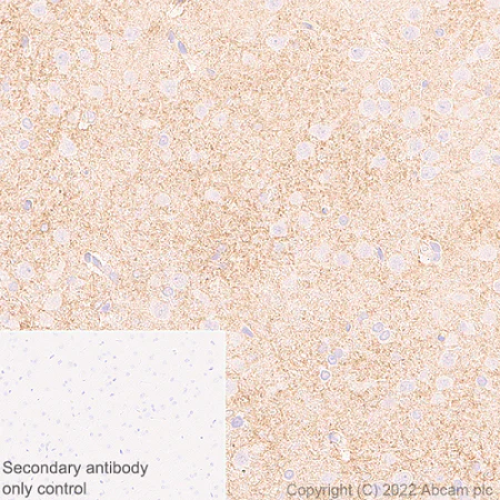 Immunohistochemistry (Formalin/PFA-fixed paraffin-embedded sections) - Anti-xCT antibody [EPR27115-64] (AB307601)