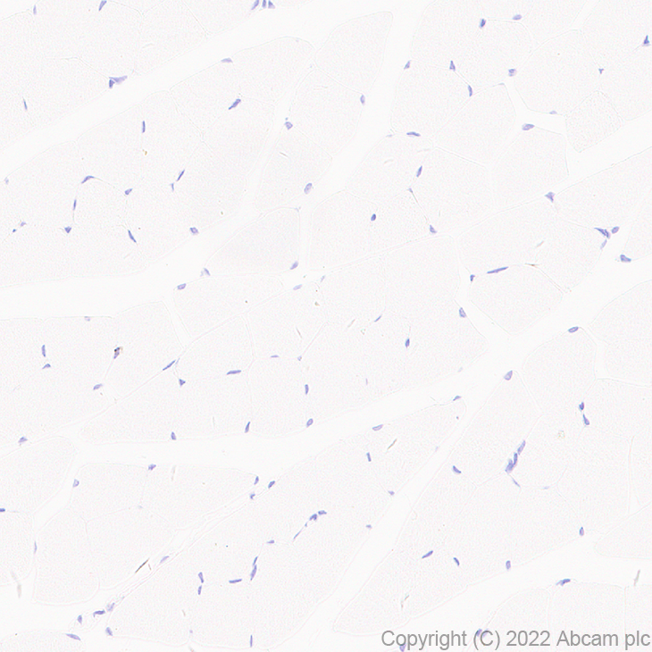 Immunohistochemistry (Formalin/PFA-fixed paraffin-embedded sections) - Anti-xCT antibody [EPR27115-64] (ab307601), expandable thumbnail