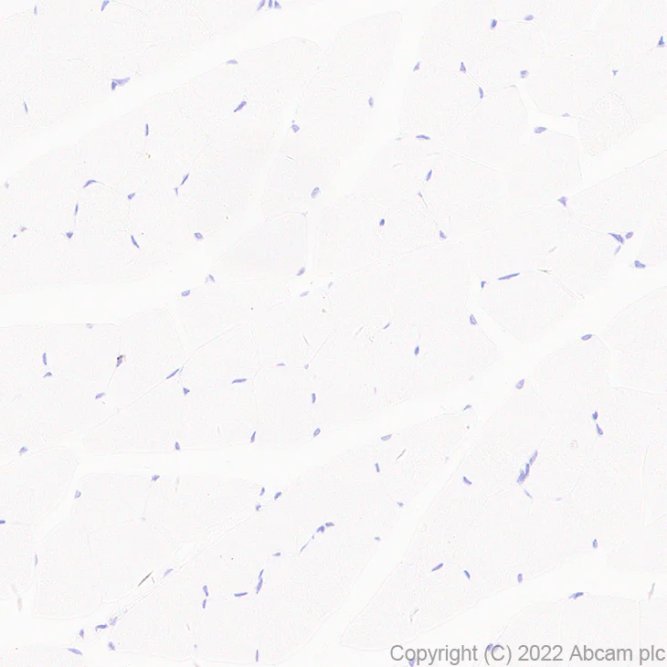 Immunohistochemistry (Formalin/PFA-fixed paraffin-embedded sections) - Anti-xCT antibody [EPR27115-64] (AB307601)