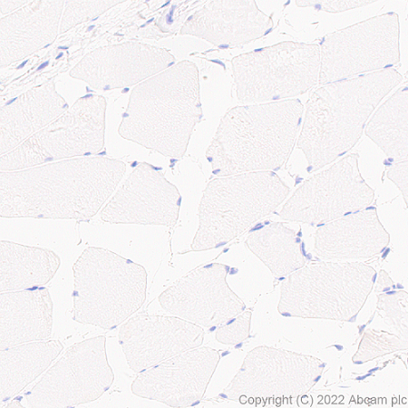 Immunohistochemistry (Formalin/PFA-fixed paraffin-embedded sections) - Anti-xCT antibody [EPR27115-64] (ab307601), expandable thumbnail