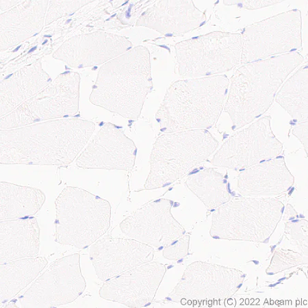Immunohistochemistry (Formalin/PFA-fixed paraffin-embedded sections) - Anti-xCT antibody [EPR27115-64] (AB307601)