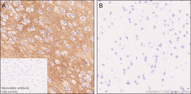 Immunohistochemistry (Formalin/PFA-fixed paraffin-embedded sections) - Anti-xCT antibody [EPR27115-64] (AB307601)