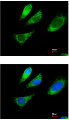 Immunocytochemistry/ Immunofluorescence - Anti-XIAP antibody (AB137392), expandable thumbnail