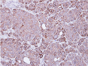 Immunohistochemistry (Formalin/PFA-fixed paraffin-embedded sections) - Anti-XIAP antibody (AB137392), expandable thumbnail