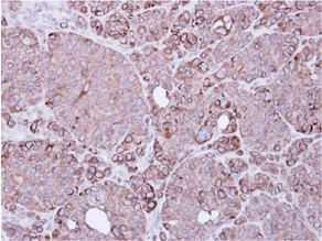 Immunohistochemistry (Formalin/PFA-fixed paraffin-embedded sections) - Anti-XIAP antibody (AB137392)