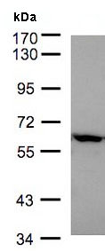 Western blot - Anti-XIAP antibody (AB137392), expandable thumbnail