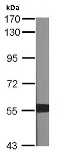 Western blot - Anti-XIAP antibody (AB137392), expandable thumbnail