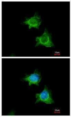 Immunocytochemistry/ Immunofluorescence - Anti-XIAP antibody (AB227196)