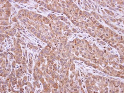 Immunohistochemistry (Formalin/PFA-fixed paraffin-embedded sections) - Anti-XIAP antibody (AB227196)