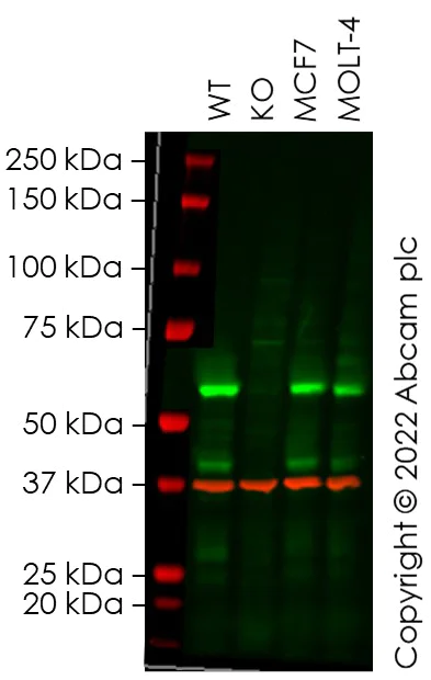Western blot - Anti-XIAP antibody [EPR22189-113] (AB229050)